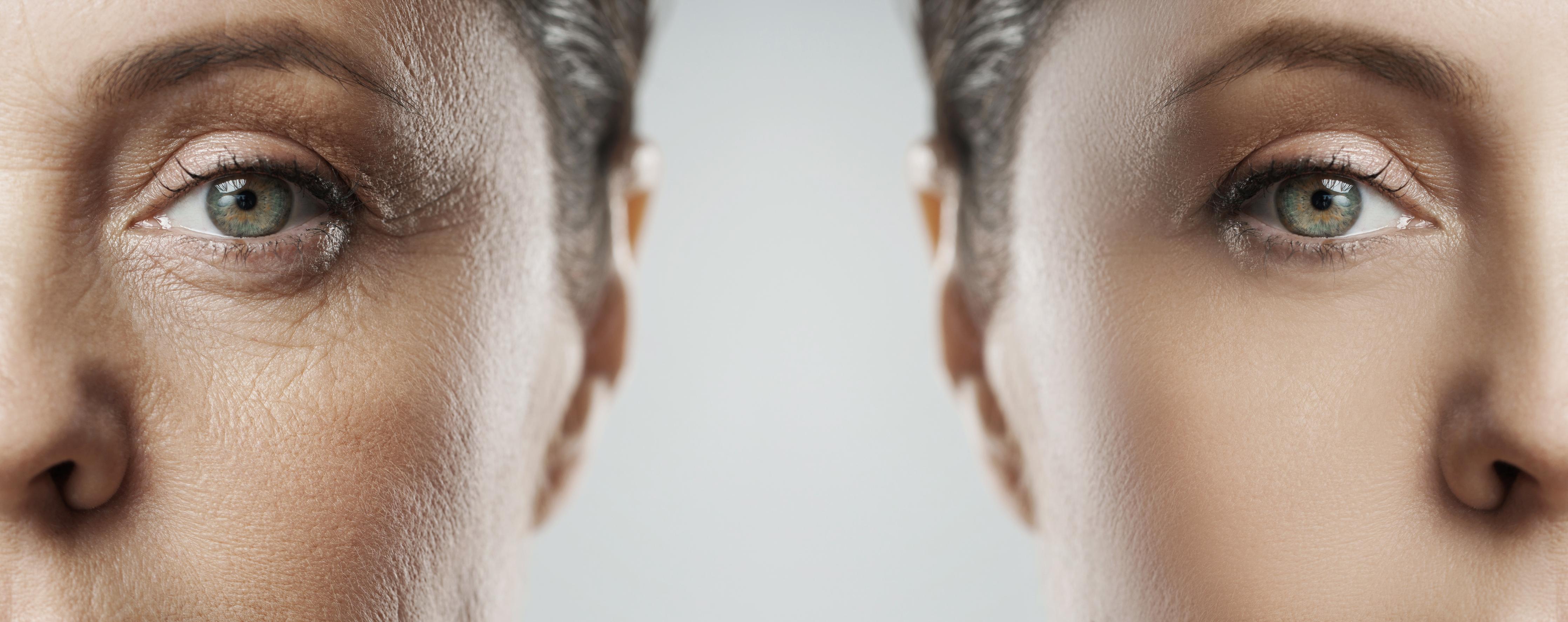 Spritzschutz-Alt und jung im Vergleich